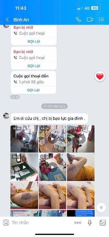 越南 🇻🇳 #家暴 被ck和他的亲生孩子多次折磨和殴打